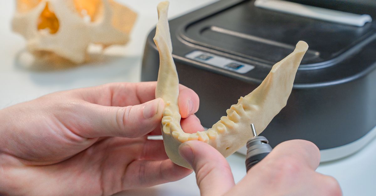 Detailed view of a 3D printed dental model being refined by a technician in a laboratory.
